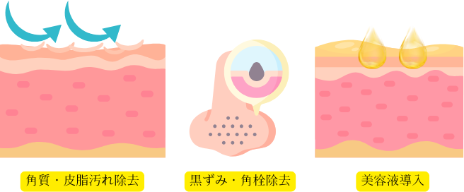 �n�C�h���s�[���@�����s�@���e�畆��