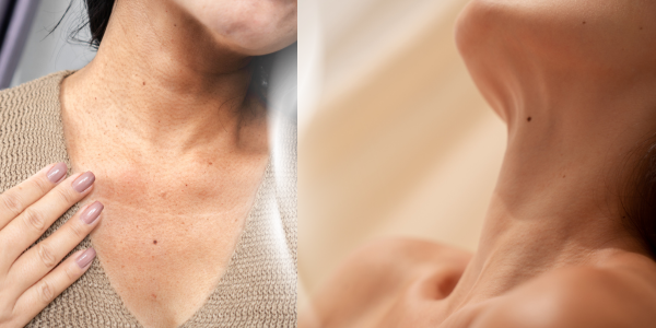 ��̘V�l���̂��݁@���[�U�[����